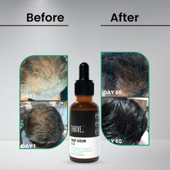 ThriveCo Hair Growth Serum 50ml