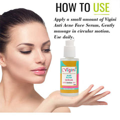 Vigini 15% Actives Anti Acne Pimple Removal Face Serum 30ml